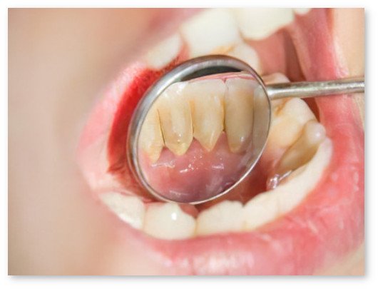 dentiste Pont à Mousson