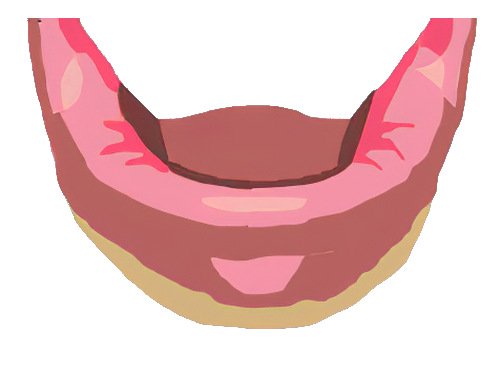 Implants dentaires Pont à Mousson