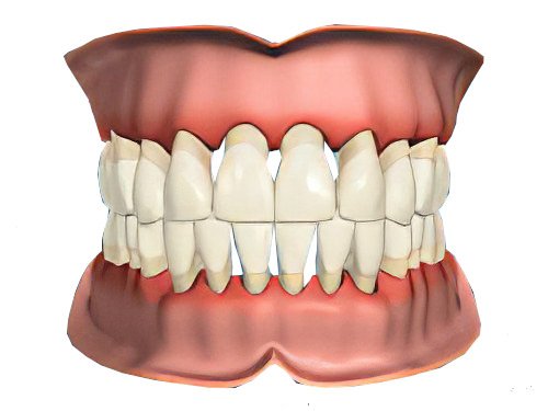 Pont a Mousson Dechaussement-Dentaire-8