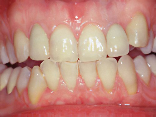 Esthétique du sourire Pont à Mousson