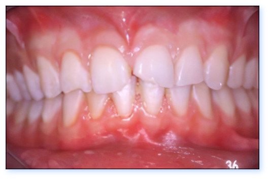 Esthétique du sourire Pont à Mousson