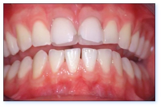 Esthétique dentaire Pont à Mousson