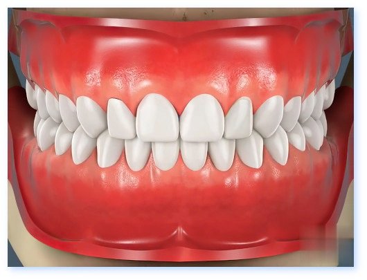 Esthétique dentaire Pont à Mousson