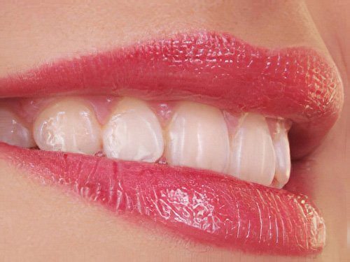 Esthétique dentaire Pont à Mousson 02